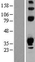 ls374739 tepp human over expression lysates nm 199456 wb testing 2