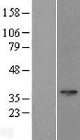 ls374768 spem1 human over expression lysates nm 199339 wb testing 1