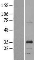 ls374875 hsd11b1l human over expression lysates nm 198533 wb testing 3