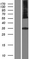 ls374875 hsd11b1l human over expression lysates nm 198706 wb testing 2