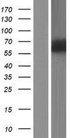 ls374899 znf829 human over expression lysates nm 001171979 wb testing 1