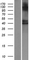 B3GNT8 Human Over-expression Lysates NM_198540
