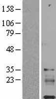 IGFL1 Human Over-expression Lysates NM_198541