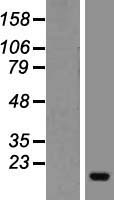 Profilin 4 (PFN4) Human Over-expression Lysates NM_199346