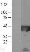 CATIP Human Over-expression Lysates NM_198559
