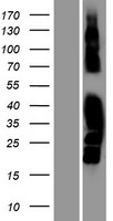 MAST4 Human Over-expression Lysates NM_198828