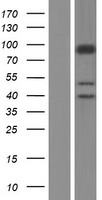 SLC26A5 Human Over-expression Lysates NM_198999