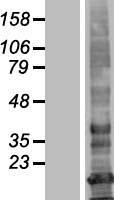 ls375612 lhfpl3 human over expression lysates nm 199000 wb testing 1