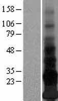 Adropin (ENHO) Human Over-expression Lysates NM_198573