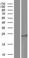 RAB15 Human Over-expression Lysates NM_198686