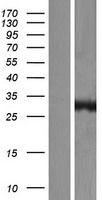 ls377677 ca13 human over expression lysates nm 198584 wb testing 1