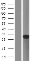 TRIM50C (TRIM74) Human Over-expression Lysates NM_198853