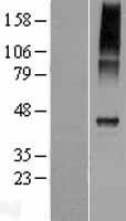 ls378807 catsper4 human over expression lysates nm 198137 wb testing 1