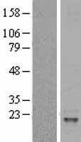 IL31 Human Over-expression Lysates NM_001014336