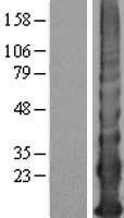 KRTAP12-4 Human Over-expression Lysates NM_198698