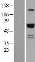 ZNF307 (ZKSCAN4) Human Over-expression Lysates NM_019110