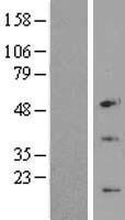 C6ORF173 (CENPW) Human Over-expression Lysates NM_001012507