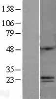 ls387263 c6orf120 human over expression lysates nm 001029863 wb testing 1