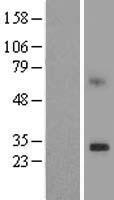 ls387521 peds1 human over expression lysates nm 199129 wb testing 1