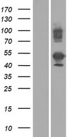 ls387522 ube2v1 tmem189 ube2v1 human over expression lysates nm 199203 wb testing 1