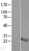 ls387758 fibin human over expression lysates nm 203371 wb testing 1
