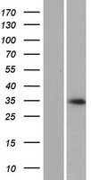 Speedy protein C (SPDYC) Human Over-expression Lysates NM_001008778