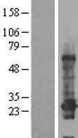C12orf68 (CCDC184) Human Over-expression Lysates NM_001013635