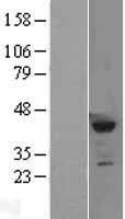 KMT5A Human Over-expression Lysates NM_020382