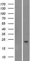 TOMM20L Human Over-expression Lysates NM_207377