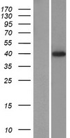 ls388199 prr25 human over expression lysates nm 001013638 wb testing 1
