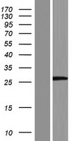 ls388341 c17orf76 lrrc75a human over expression lysates nm 207387 wb testing 2