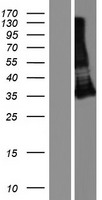 ls388364 tmigd1 human over expression lysates nm 206832 wb testing 1