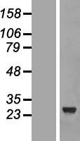 CCDC103 Human Over-expression Lysates NM_213607