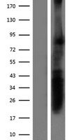 RPRML Human Over-expression Lysates NM_203400