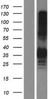 CLEC17A Human Over-expression Lysates NM_207390