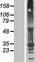 TMEM82 Human Over-expression Lysates NM_001013641