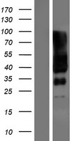 SLC6A17 Human Over-expression Lysates NM_001010898