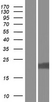 ls388695 lysmd1 human over expression lysates nm 001136543 wb testing 2