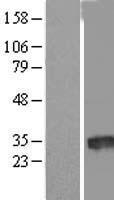 ls388882 fam230i human over expression lysates nm 001006606 wb testing 1