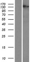 ls388939 pcare human over expression lysates nm 001029883 wb testing 1