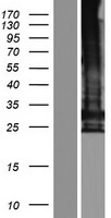 TMEM247 Human Over-expression Lysates NM_001145051