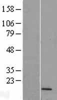 FUNDC2P2 Human Over-expression Lysates NM_001013648
