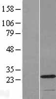 C2orf68 Human Over-expression Lysates NM_001013649
