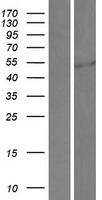 SP5 Human Over-expression Lysates NM_001003845