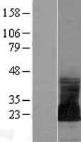 ls389084 snorc human over expression lysates nm 206895 wb testing 1