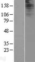 ls389123 iqcf2 human over expression lysates nm 203424 wb testing 1