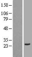 ANXA2R Human Over-expression Lysates NM_001014279