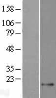 ls389320 tex43 human over expression lysates nm 207408 wb testing 1