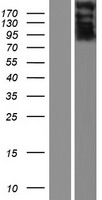 ls389333 prob1 human over expression lysates nm 001161546 wb testing 1