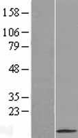 SFTA2 Human Over-expression Lysates NM_205854